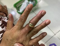 Jari Nenek 64 Tahun Bengkak Karena Cincin, Damkar Sidoarjo Bantu Melepaskan