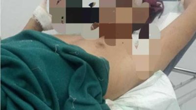 Wartawan Dibacok Preman di Tambang Galian C  Tuban