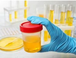 Pastikan Bebas Narkoba, Seluruh Anggota DPRD Bondowoso Jalani Pemeriksaan Tes Urine