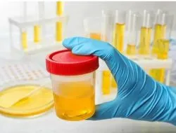 Pastikan Bebas Narkoba, Seluruh Anggota DPRD Bondowoso Jalani Pemeriksaan Tes Urine